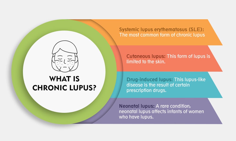 What Is Chronic Lupus? 