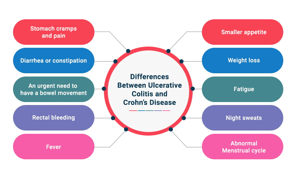 Differences Between Ulcerative Colitis and Crohn’s Disease