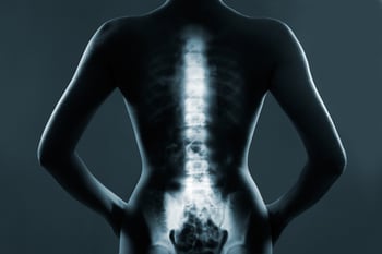 Spinal Disorders and Disability